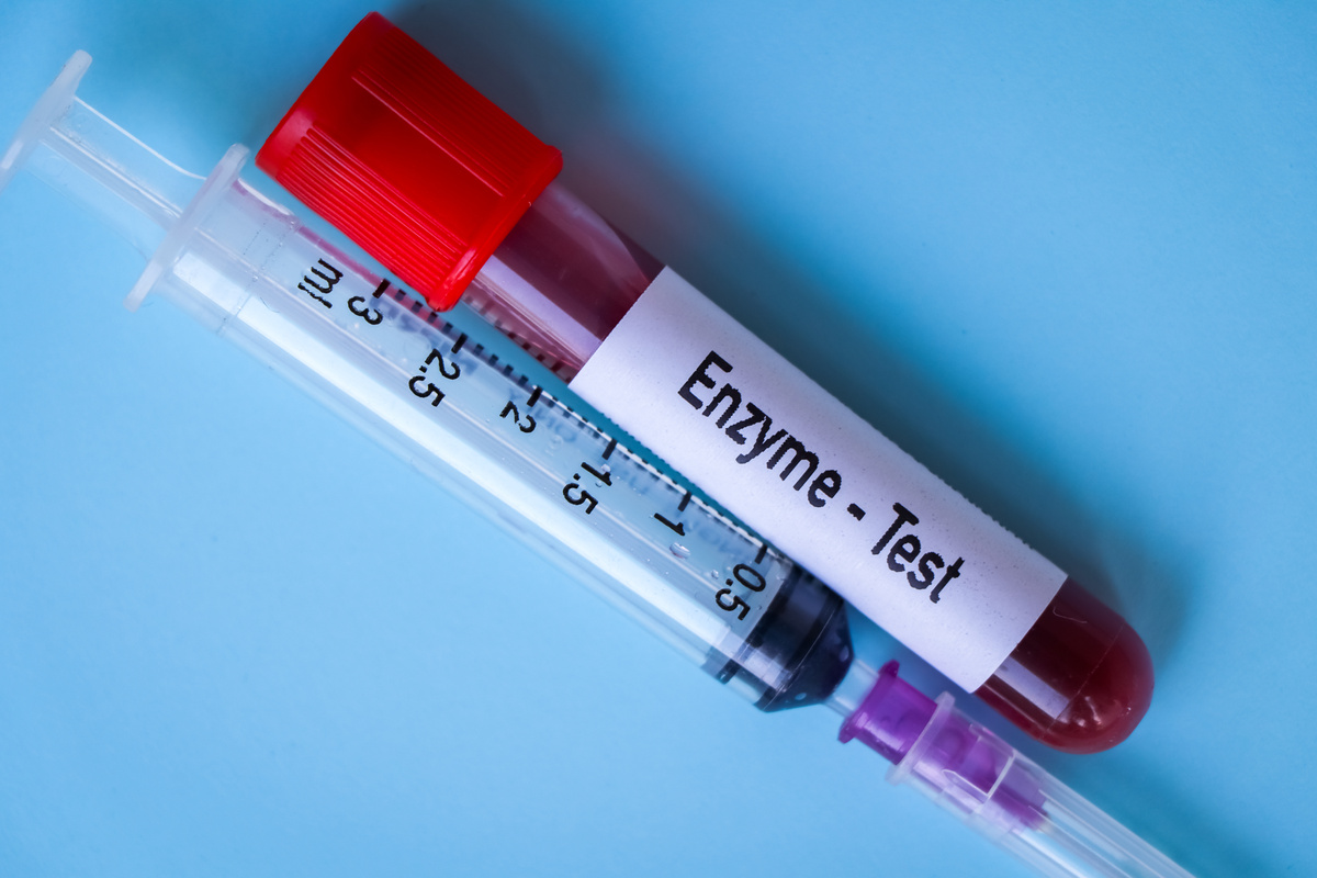 Enzyme test, blood sample to analyze in the laboratory